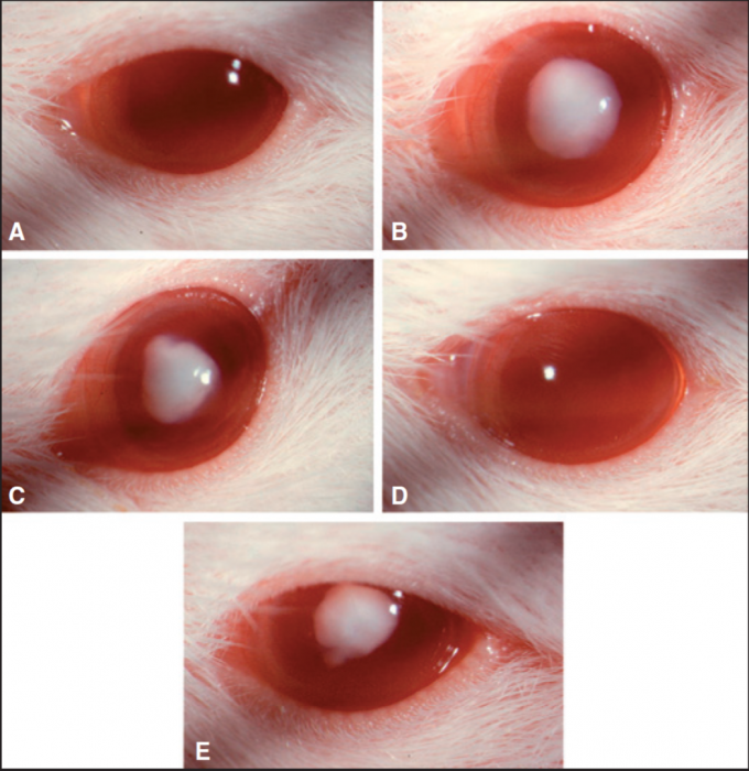 37vb-cataracte.png 37vb-cataracte.png
