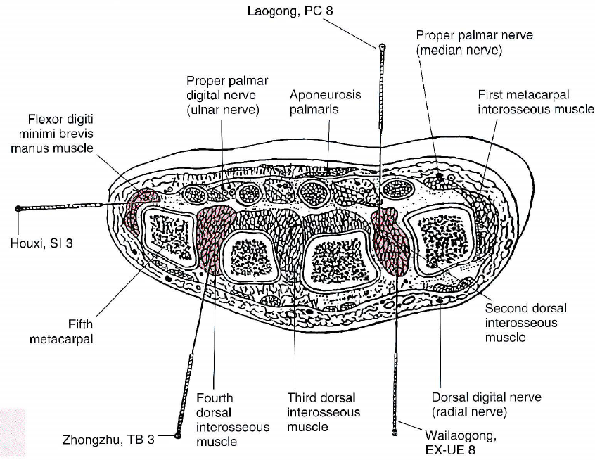 8mctransversal.png 8mctransversal.png