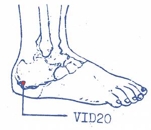 vi-d20.jpg vi-d20.jpg