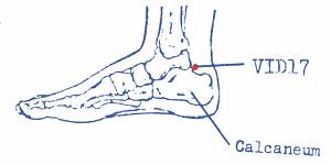 vi-d17.jpg vi-d17.jpg